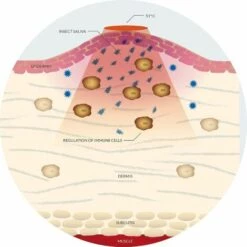 FONTAINEBLEAU Appareil Soulageant Les Piqûres D'insectes，Pour Piqures D'insectes Fonepro Blanc -Outil d'entretien du jardin Soldes 59835776 4